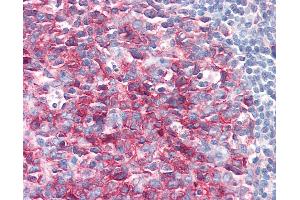 Anti-PAG1 / PAG antibody IHC of human tonsil. (PAG1 anticorps  (AA 97-432))