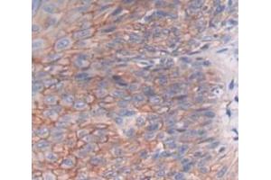 Used in DAB staining on fromalin fixed paraffin- embedded skin cancer tissue (DHODH anticorps  (AA 35-392))