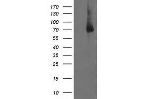 Western Blotting (WB) image for anti-LIM Domain Kinase 1 (LIMK1) antibody (ABIN1499145)