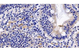 Detection of TNFR1 in Porcine Small intestine Tissue using Polyclonal Antibody to Tumor Necrosis Factor Receptor 1 (TNFR1)