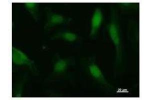 Immunostaining analysis in HeLa cells.