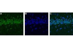 Expression of CALHM1 in rat hippocampus - Immunohistochemical staining of rat hippocampus using Anti-CALHM1 Antibody (ABIN7043013, ABIN7044044 and ABIN7044045). (CALHM1 anticorps  (Intracellular))