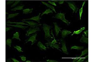 Immunofluorescence of monoclonal antibody to HTT on HeLa cell. (Huntingtin anticorps  (AA 1524-1627))