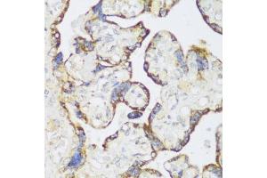Immunohistochemistry of paraffin-embedded human placenta using ECH1 antibody  at dilution of 1:150 (40x lens). (ECH1 anticorps  (AA 1-328))