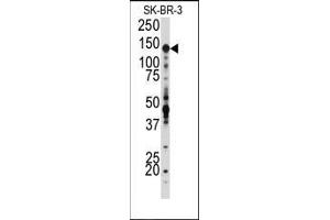 Western blot analysis of anti-IGF1R Antibody (N-term) in SK-BR-3 cell line lysates (35ug/lane). (IGF1R anticorps  (N-Term))