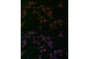 Immunofluorescence analysis of Jurkat cells using CD99 Rabbit pAb (ABIN3022730, ABIN3022731, ABIN3022732, ABIN1512728 and ABIN6219199) at dilution of 1:25 (40x lens). (CD99 anticorps  (AA 23-185))