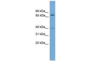 Image no. 1 for anti-Multiple Endocrine Neoplasia 1 (MEN1) (AA 351-400) antibody (ABIN6744537) (Menin anticorps  (AA 351-400))