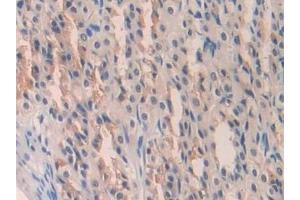 Detection of IL18 in Rat Stomach Tissue using Polyclonal Antibody to Interleukin 18 (IL18)