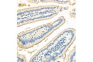 Immunohistochemistry of paraffin embedded mouse jejunum using Treh (ABIN7076006) at dilution of 1:700 (320x lens)