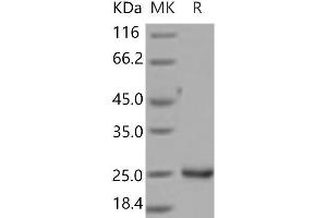 Western Blotting (WB) image for Lipocalin 2 (LCN2) (Active) protein (His tag) (ABIN7321230) (Lipocalin 2 Protein (LCN2) (His tag))