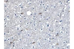 Detection of β-catenin in Human Cerebrum Tissue using Polyclonal Antibody to Beta Catenin (β-catenin)