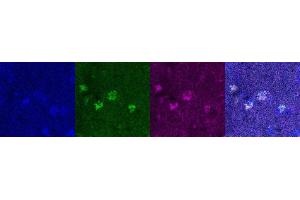 Immunohistochemistry (IHC) image for anti-Oligodendrocyte Lineage Transcription Factor 2 (OLIG2) antibody (ABIN7456327) (OLIG2 anticorps)