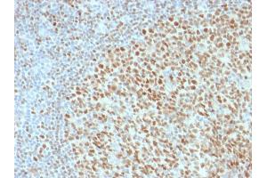 Formalin-fixed, paraffin-embedded human Tonsil stained with Oct-2 Mouse Monoclonal Antibody (OCT2/2136).