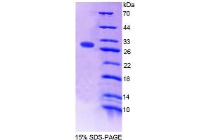 SDS-PAGE analysis of Mouse FPGS Protein. (FPGS Protéine)