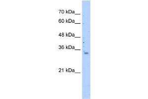 WB Suggested Anti-MRPS15 Antibody Titration: 0. (MRPS15 anticorps  (N-Term))