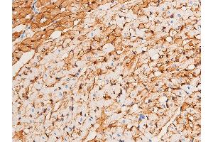 ABIN6267221 at 1/100 staining rat heart tissue sections by IHC-P.