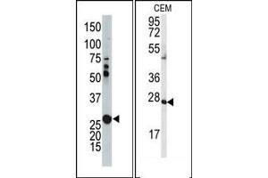 Image no. 1 for anti-Adenylate Kinase 2 (AK2) (N-Term) antibody (ABIN360624)