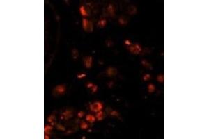 Immunofluorescence (IF) image for anti-Lin-28 Homolog A (C. Elegans) (LIN28A) antibody (ABIN2995304) (LIN28A anticorps)