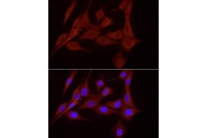 Immunofluorescence analysis of NIH/3T3 cells using SLC7/xCT Rabbit pAb (ABIN6134319, ABIN6148046, ABIN6148047 and ABIN6217771) at dilution of 1:200 (40x lens).