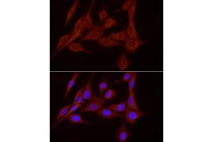 Immunofluorescence analysis of NIH/3T3 cells using SLC7/xCT Rabbit pAb (ABIN6134319, ABIN6148046, ABIN6148047 and ABIN6217771) at dilution of 1:200 (40x lens). (SLC7A11 anticorps  (AA 150-250))