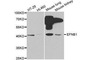 Western blot analysis of extracts of various cell lines, using EFNB1 antibody.