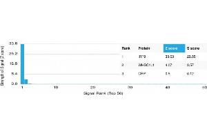 anti-Interferon Regulatory Factor 9 (IRF9) antibody