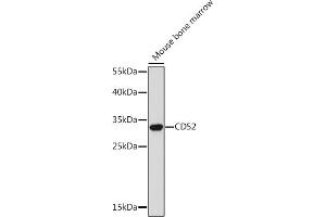 Western blot analysis of extracts of Mouse bone marrow, using CD52 Rabbit pAb (ABIN7266207) at 1:300 dilution.
