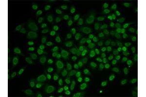 anti-RAD54-Like 2 (RAD54L2) (AA 1178-1467) antibody