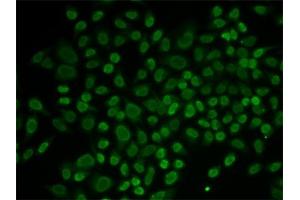 Immunofluorescence analysis of MCF-7 cells using RL2 antibody (ABIN6132938, ABIN6146651, ABIN6146653 and ABIN6217641). (ARIP4 anticorps  (AA 1178-1467))