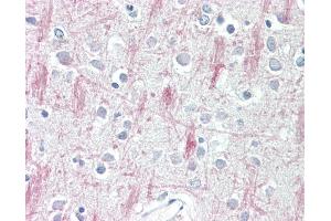 Anti-GPR125 antibody IHC staining of human brain, cortex. (GPR125 anticorps  (AA 1098-1109))