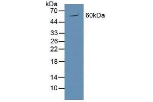 Detection of PODXL in Mouse Brain Tissue using Polyclonal Antibody to Podocalyxin (PODXL)