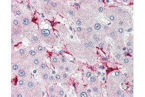 TSKS antibody was used for immunohistochemistry at a concentration of 4-8 ug/ml.