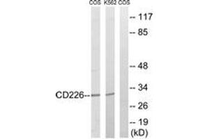 Western blot analysis of extracts from COS7/K562 cells, treated with PMA 125ng/ml 30' , using CD226/DNAM-1 (Ab-329) Antibody. (CD226 anticorps  (AA 287-336))