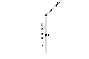 Anti-LRP1B Antibody at 1:2000 dilution + Recombinant protein Lysates/proteins at 20 μg per lane. (LRP1B anticorps)