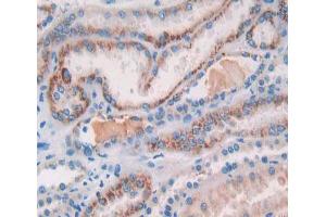 Used in DAB staining on fromalin fixed paraffin- embedded kidney tissue (COL18A1 anticorps  (AA 1154-1335))