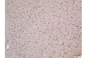 Formalin-fixed and paraffin embedded rat brain labeled with Rabbit Anti-XPB Polyclonal Antibody, Unconjugated (ABIN706031) at 1:200 followed by conjugation to the secondary antibody and DAB staining (ERCC3 anticorps  (AA 601-700))