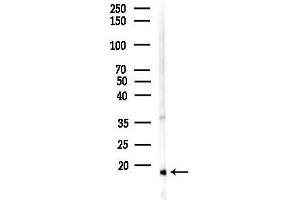 anti-Tumor Suppressor Candidate 2 (TUSC2) (Internal Region) antibody
