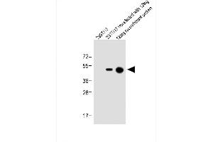 All lanes : Anti-His Tag Antibody at 1:1000 dilution Lane 1: 293T/17 whole cell lysate Lane 2: 293T/17 transfected with 12tag whole cell lysate Lane 3: 12tag recombinant protein Lysates/proteins at 1 μg per lane. (His Tag anticorps)