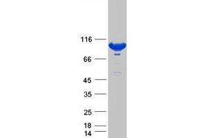 Validation with Western Blot (STAT5A Protein (Myc-DYKDDDDK Tag))