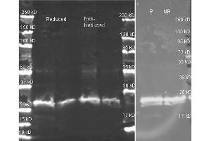 anti-GST polyclonal antibody  in western blot shows detection of recombinant GST (indicated by band at ~ 28 kDa).