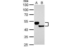 WB Image Cytokeratin 13 antibody detects KRT13 protein by Western blot analysis. (Cytokeratin 13 anticorps)