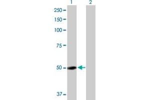 Western Blot analysis of GC expression in transfected 293T cell line by GC MaxPab polyclonal antibody. (Vitamin D-Binding Protein anticorps  (AA 1-474))