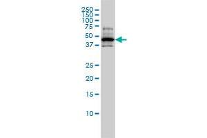 RCC1 monoclonal antibody (M01), clone 2F1 Western Blot analysis of RCC1 expression in A-431 . (RCC1 anticorps  (AA 312-421))