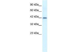 WB Suggested Anti-ESR2 Antibody Titration: 0. (ESR2 anticorps  (N-Term))
