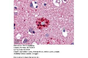Immunohistochemistry with Human Brain, cortex, senile plaque tissue at an antibody concentration of 5. (TCF21 anticorps  (N-Term))