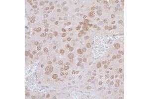 Immunohistochemistry (IHC) image for anti-Thymopoietin (TMPO) (AA 200-250) antibody (ABIN7453438)
