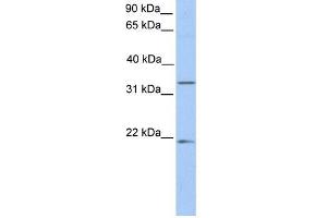 FUT6 antibody used at 1 ug/ml to detect target protein.