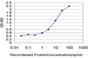 Detection limit for recombinant GST tagged KDM5B is approximately 0. (KDM5B anticorps  (AA 231-319))