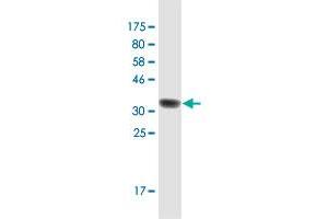 Western Blot detection against Immunogen (36. (RAB3B anticorps  (AA 120-219))