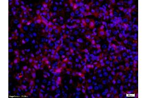 Formalin-fixed and paraffin embedded mouse melanoma labeled with Anti- MITF Polyclonal Antibody, Unconjugated  at 1:200 followed by conjugation to the secondary antibody Goat Anti-Rabbit IgG, PE conjugated-PE)used at 1:200 dilution for 40 minutes at 37°C and DAPI
